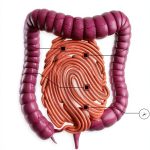 Irritable Bowel Syndrome Relief Guide by Amazon Kindle-0